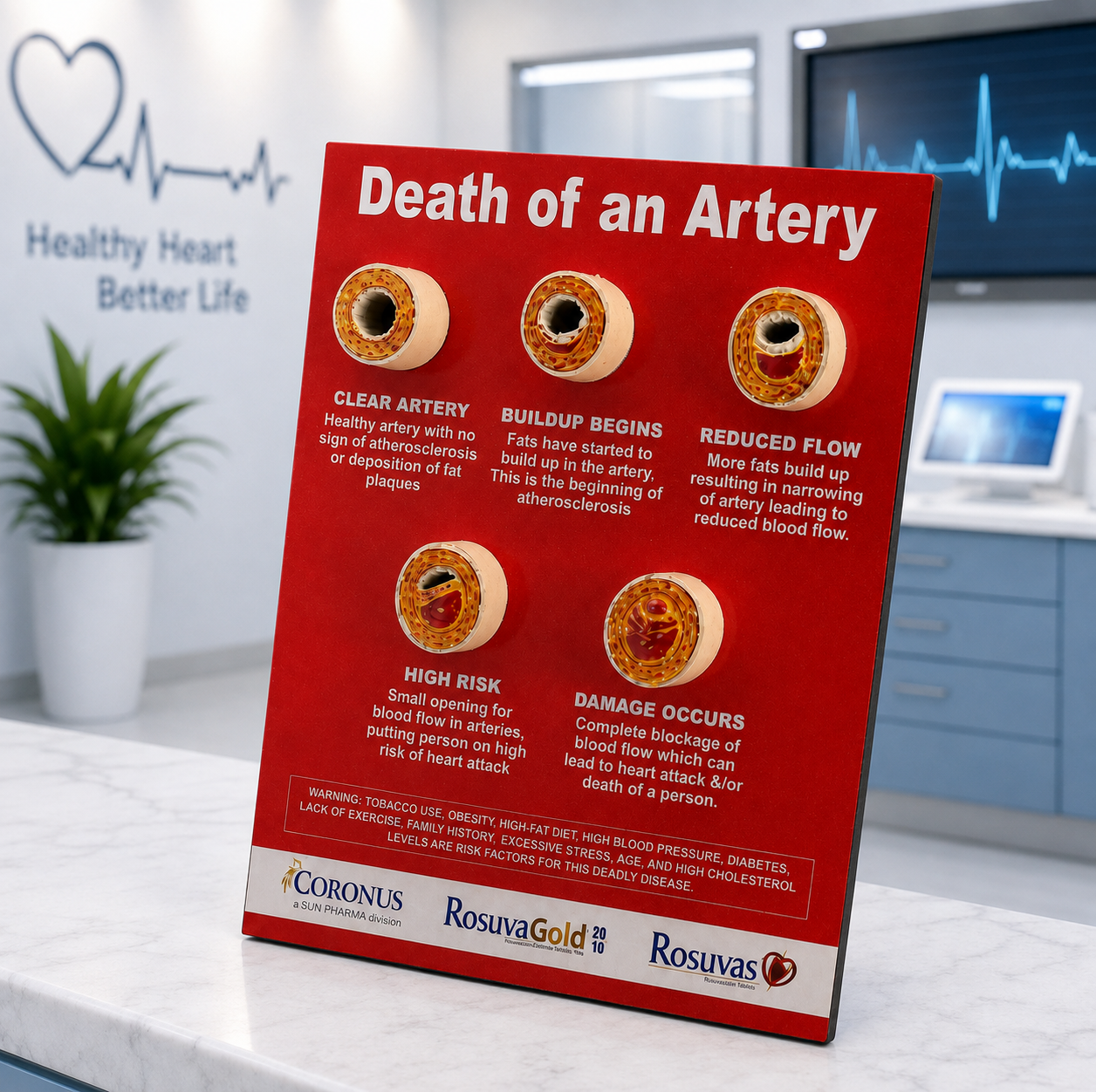Death Of An Artery Anatomical Poster