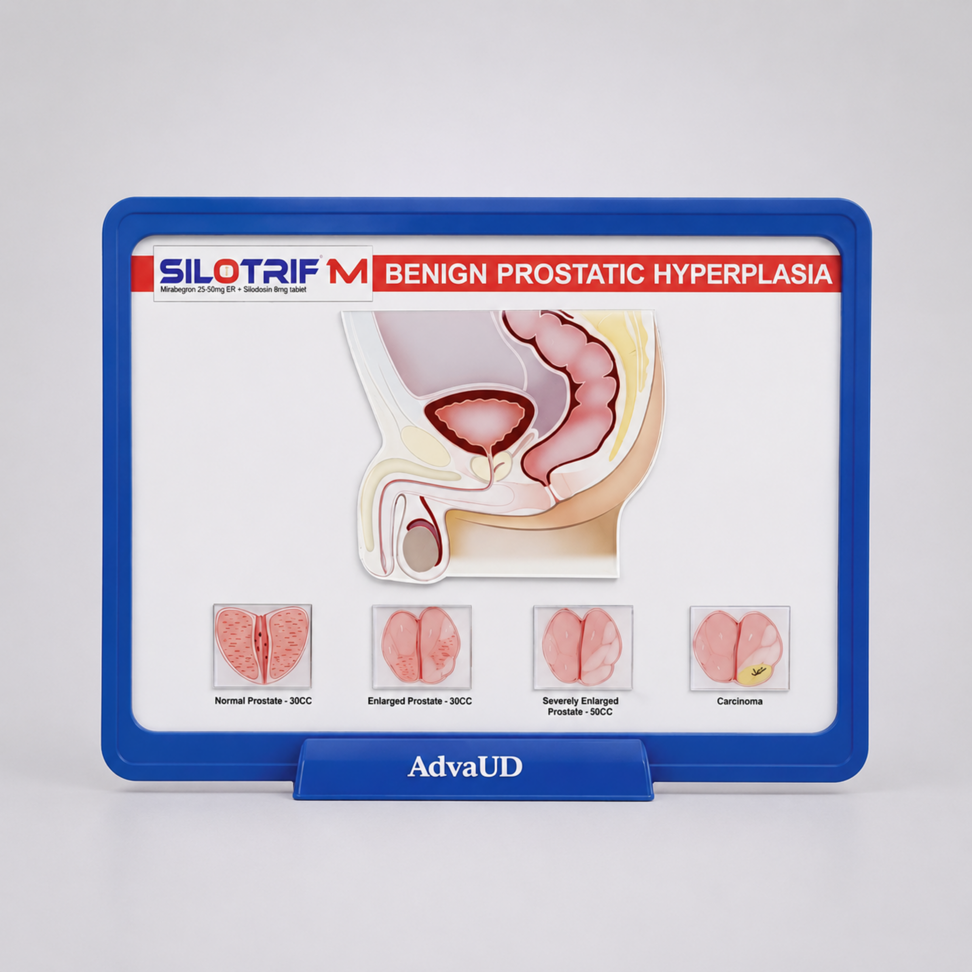 PROSTATE ANATOMICAL EDUSTAND