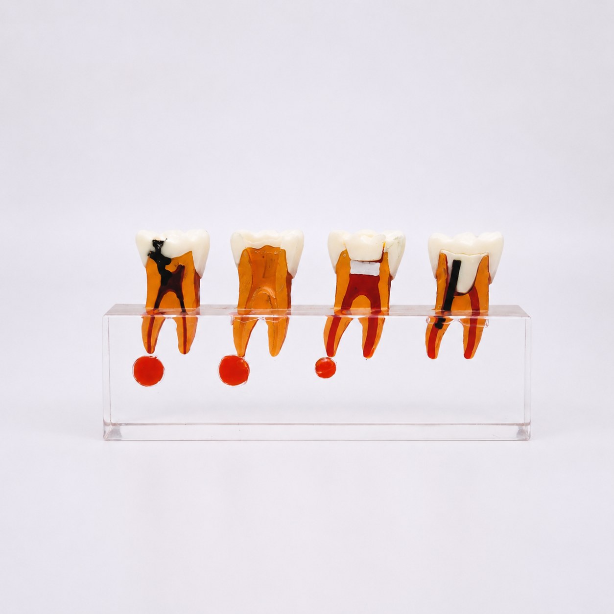 4 STAGE ENDODONTIC TREATMENT MODEL